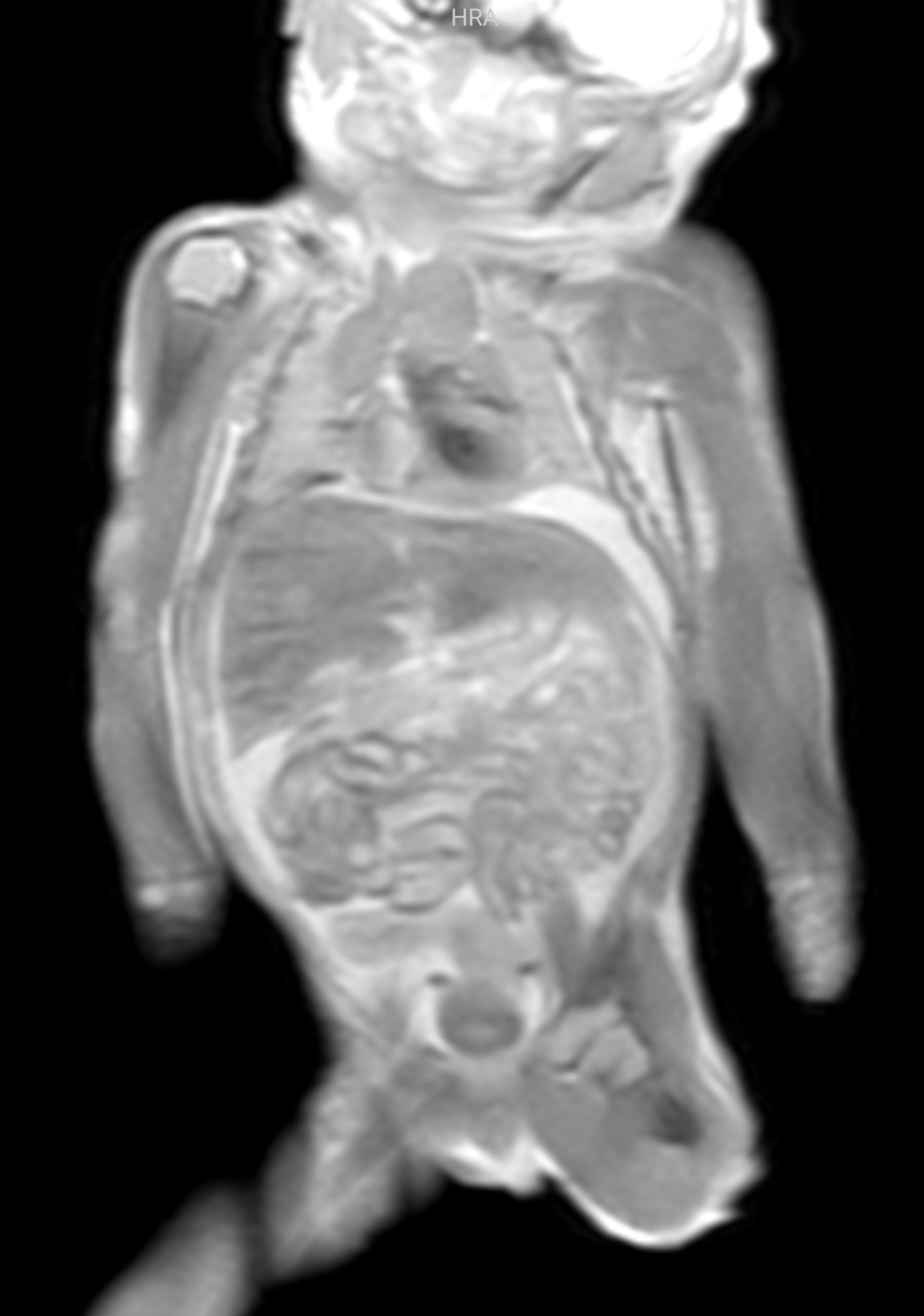 Course Image Post-mortem Foetal MRI Course
